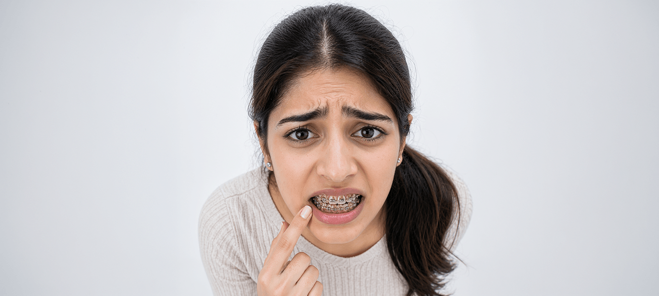 Braces & Aligners Care