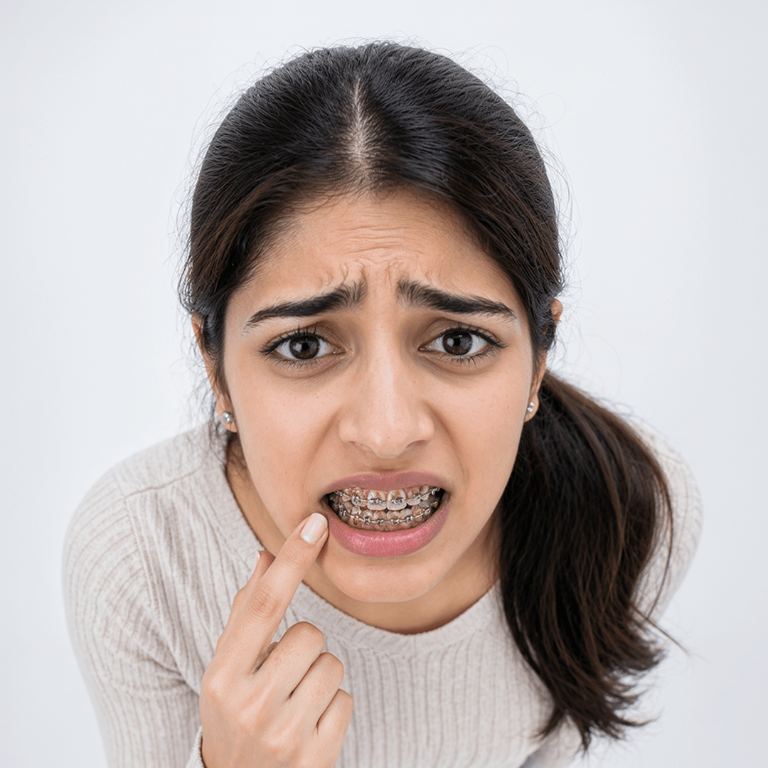 Braces Care
