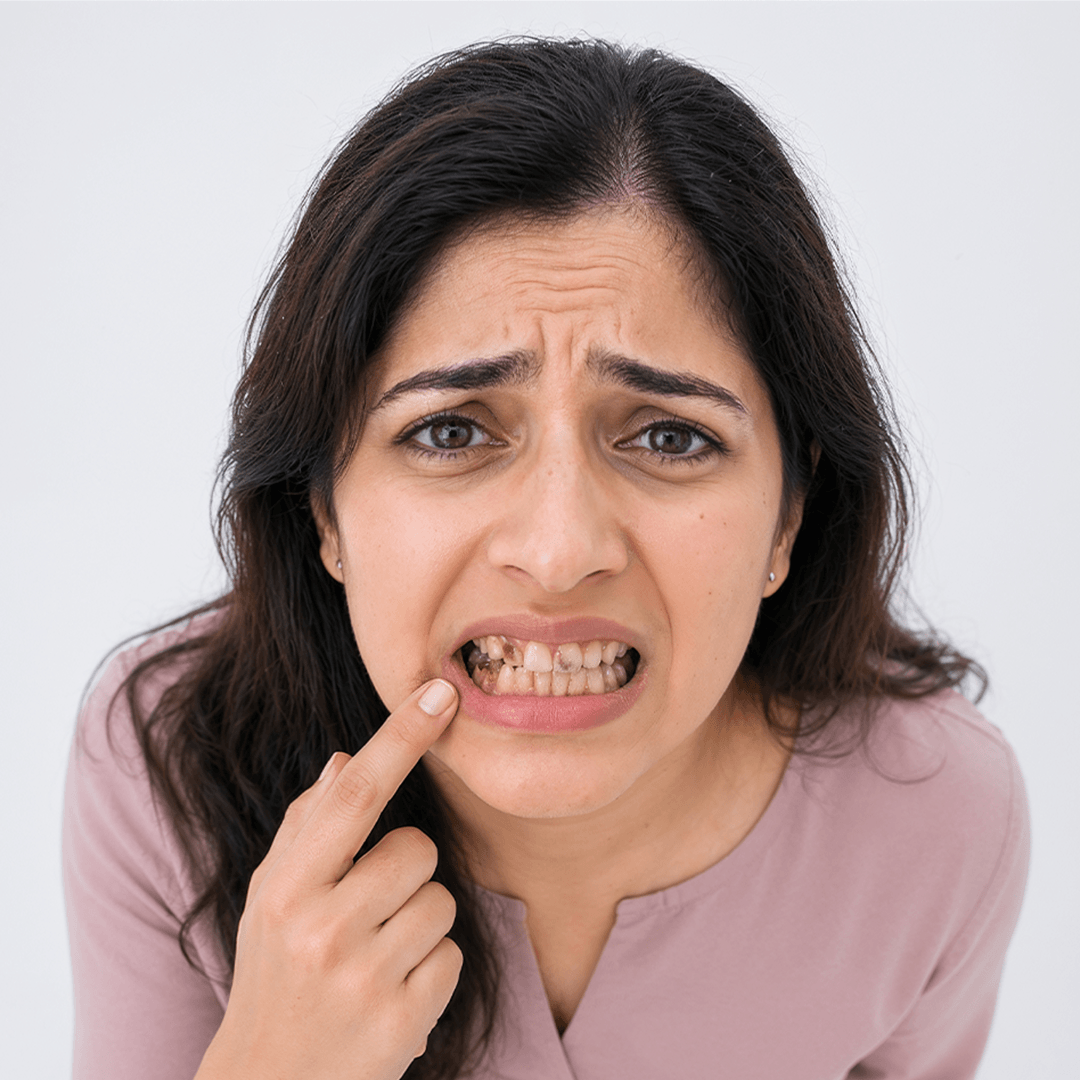 Cavity Protection